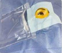 Ophthalmic drapes